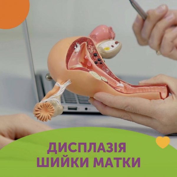 Дисплазія шийки матки