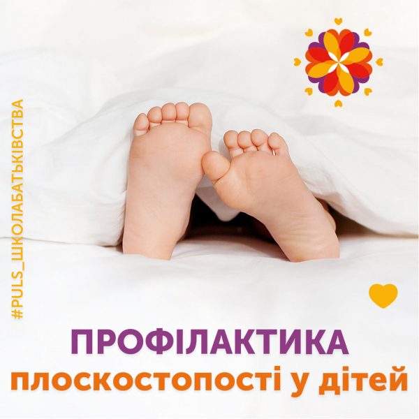 Плоскостопість у дітей: профілактика, симптоми, лікування