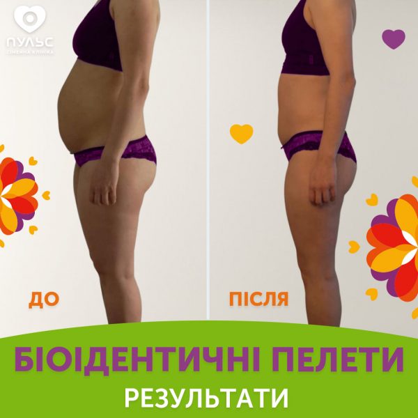 Результат від використання біоідентичних пелет