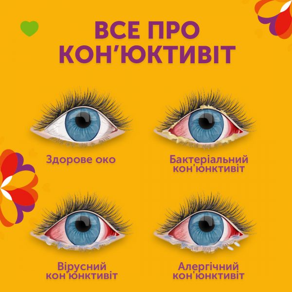 Все про кон’юктивіт