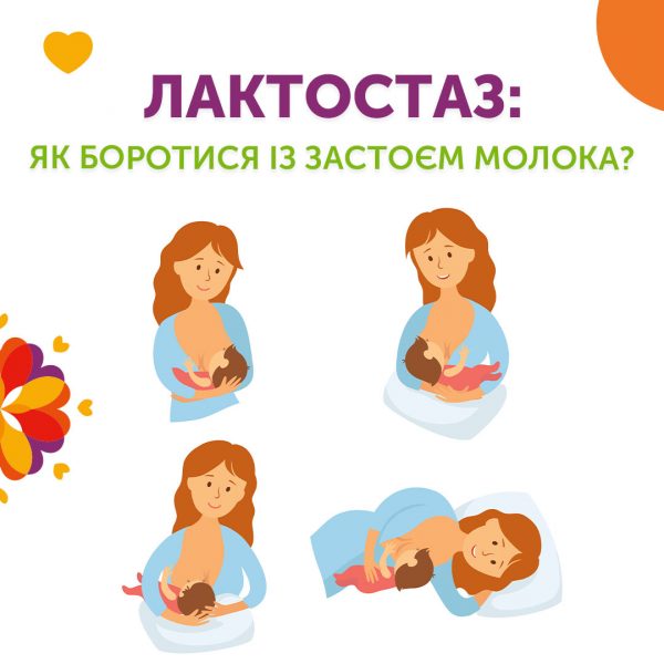 Лактостаз: як боротися із застоєм молока?