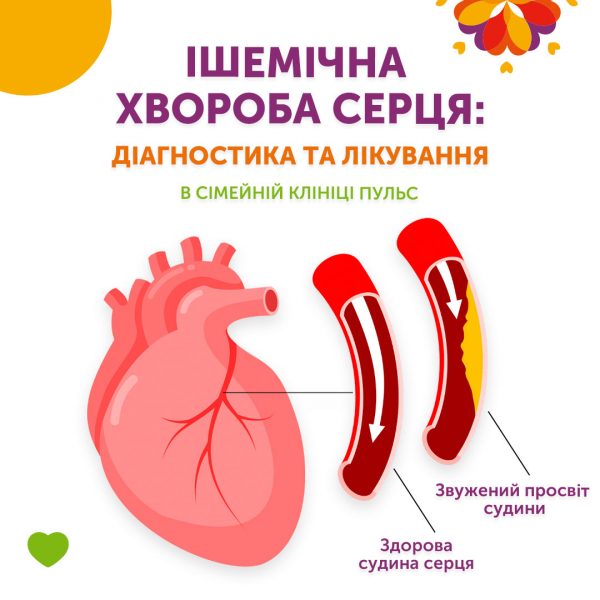 Ішемічна хвороба серця: діагностика та лікування