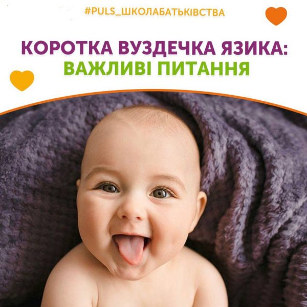Коротка вуздечка язика: важливі питання