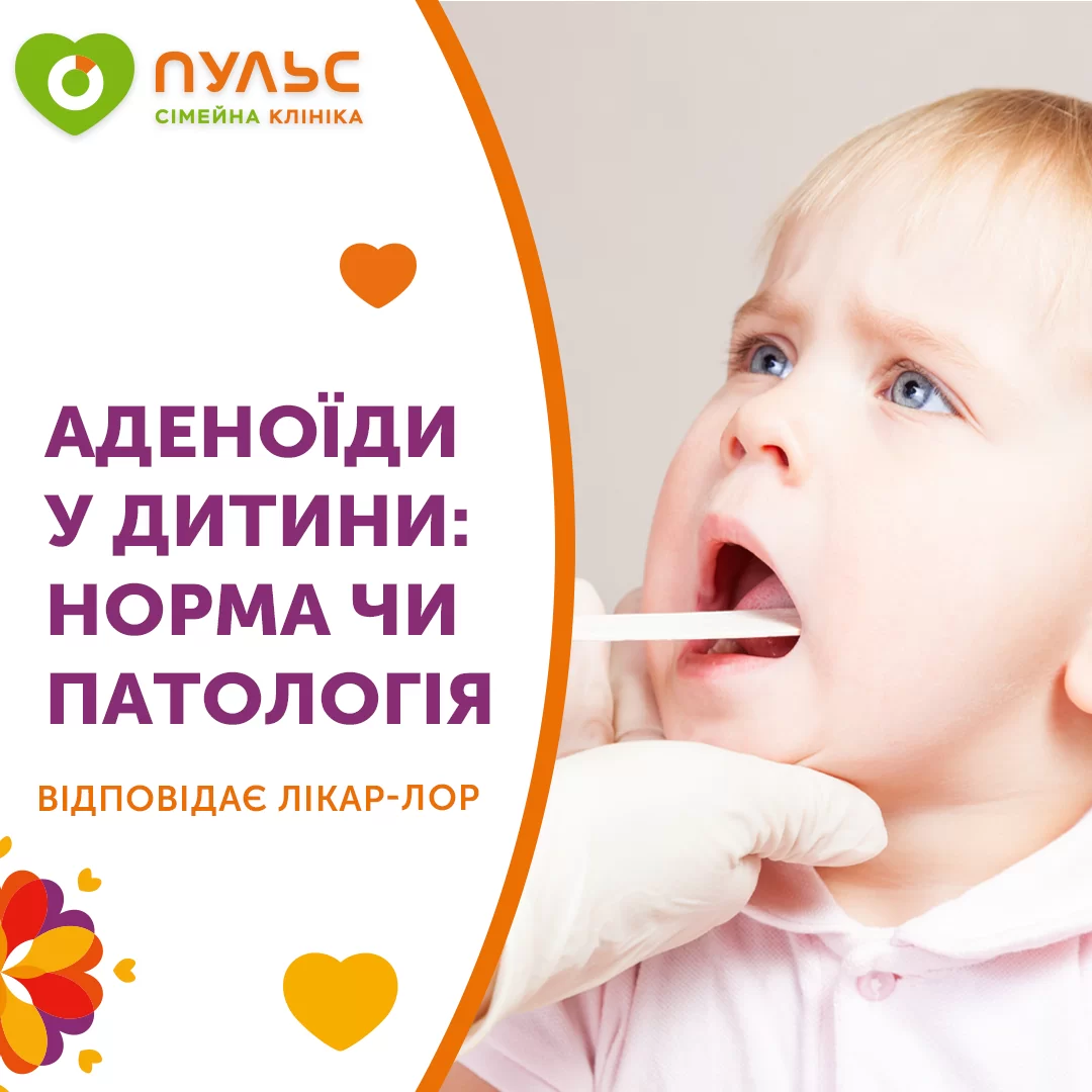 Аденоиды у ребенка норма или патология?