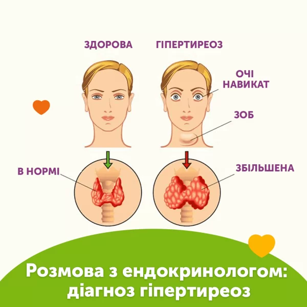 Разговор с эндокринологом: диагноз гипертиреоз