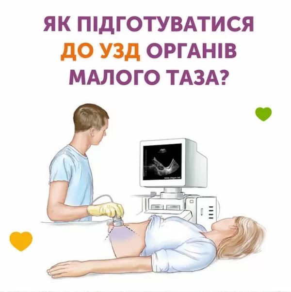 Как подготовиться к УЗИ органов малого таза?