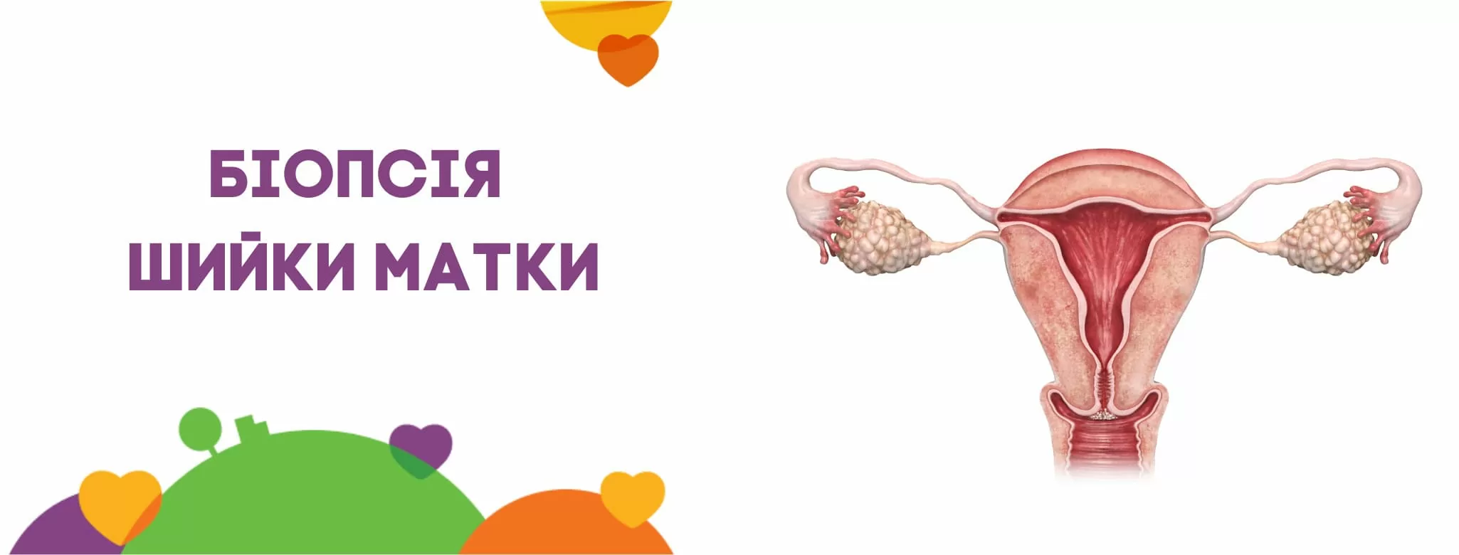 Біопсія шийки матки