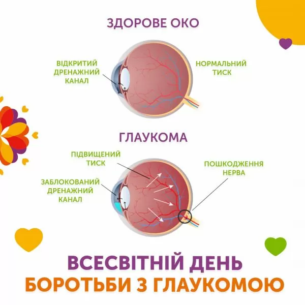 Всемирный день борьбы с глаукомой 👁