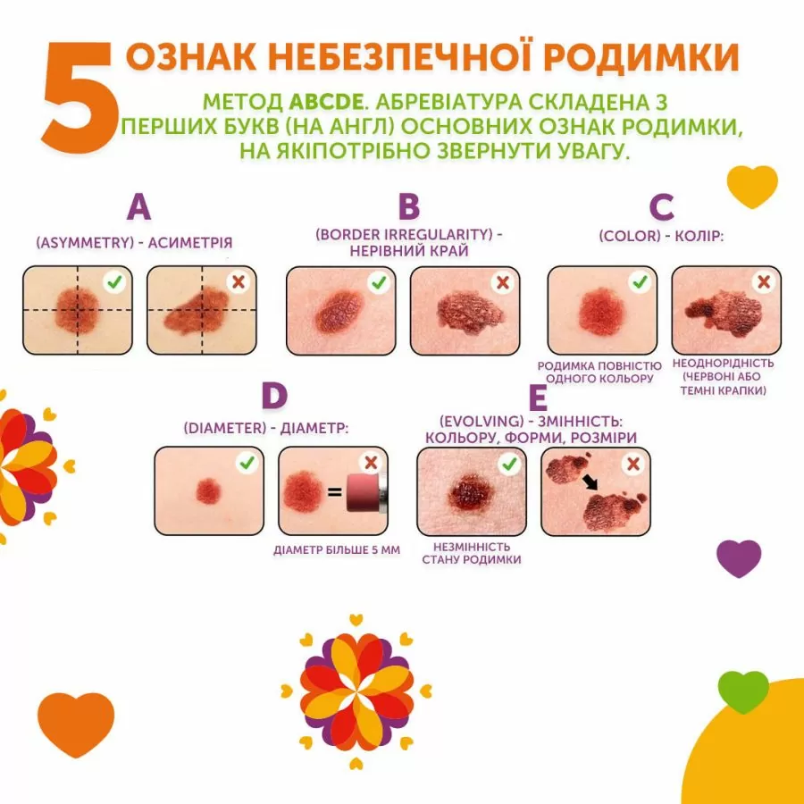 Чек-лист по проверке родинок