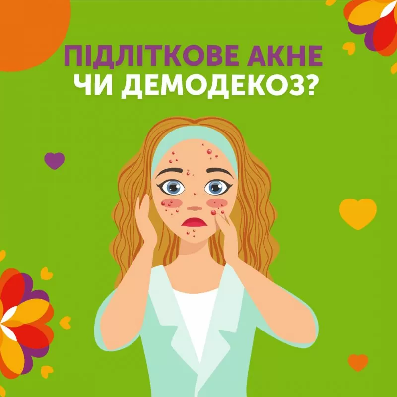 Подрастковое акне или демодекоз?