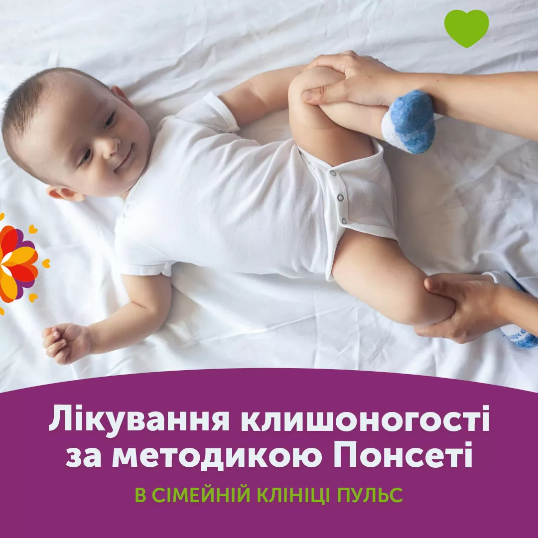 Лікування клишоногості за методикою Понсеті в сімейній клініці Пульс