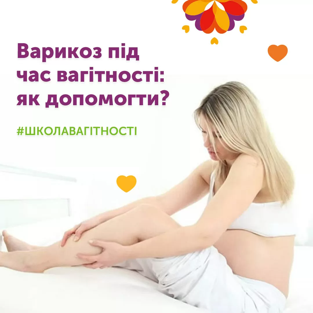 Варикоз во время беременности: как помочь?