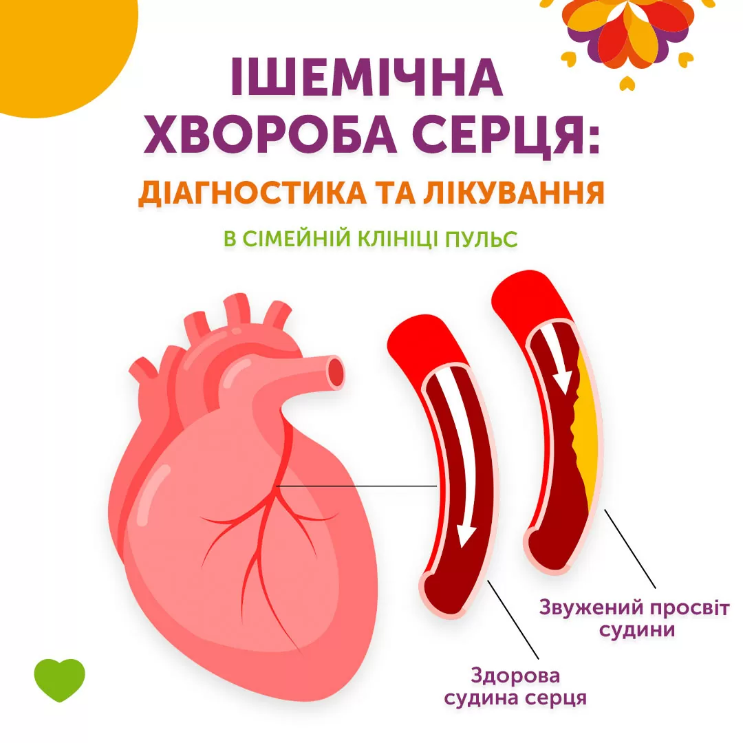 Ішемічна хвороба серця: діагностика та лікування